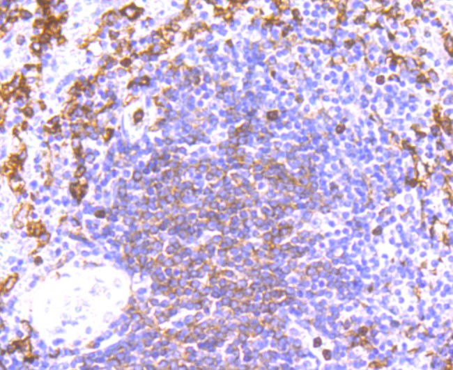 Immunohistochemical analysis of paraffin-embedded human spleen tissue using anti-NOX2/gp91phox antibody. Counter stained with hematoxylin.