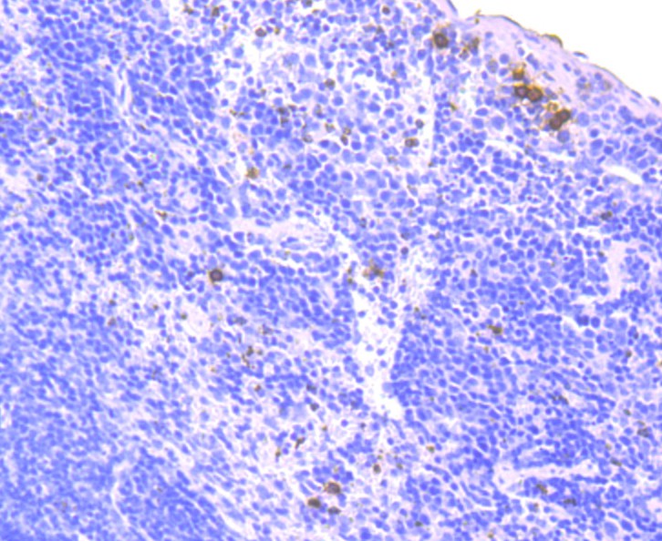 Immunohistochemical analysis of paraffin-embedded mouse spleen tissue using anti-NOX2/gp91phox antibody. Counter stained with hematoxylin.