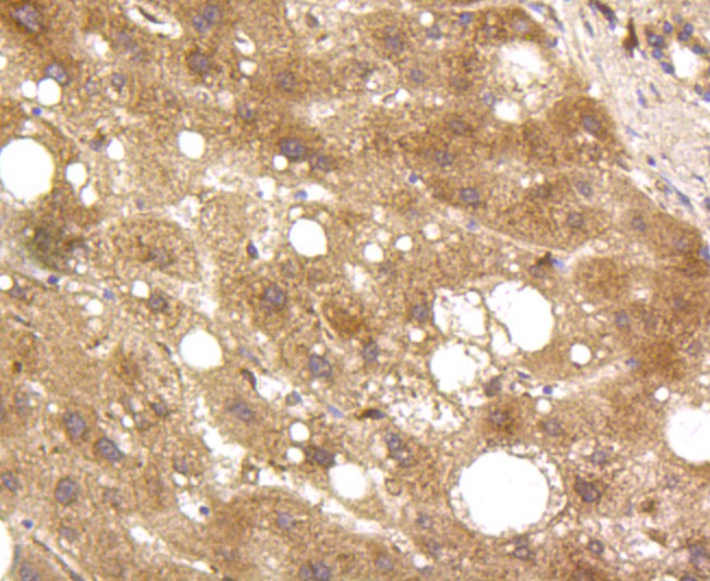 Immunohistochemical analysis of paraffin-embedded human liver tissue using anti-GRP94 antibody. Counter stained with hematoxylin.
