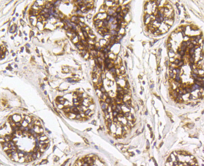 Immunohistochemical analysis of paraffin-embedded human breast tissue using anti-GRP94 antibody. Counter stained with hematoxylin.