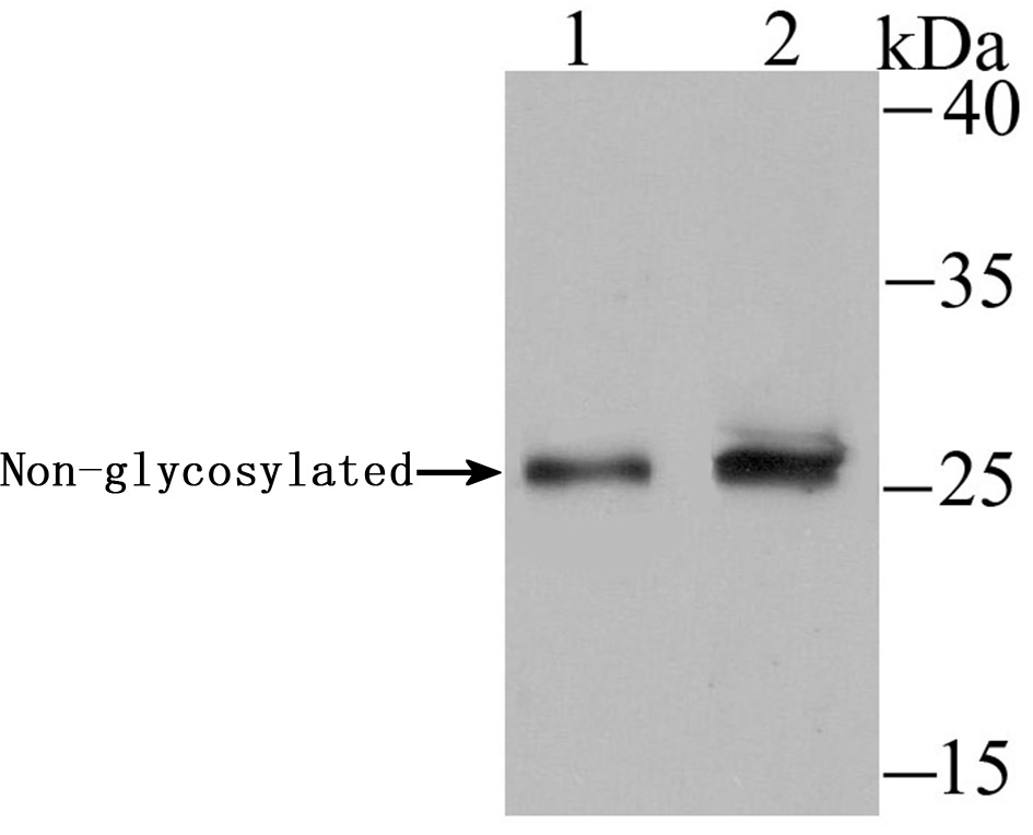 Western blot analysis of DKK1 on different tissue lysates using anti-DKK1 antibody at 1/500 dilution.<br />
 Positive control:<br />
 Lane 1: Mouse brain  <br />
  Lane 2: Human fetal brain