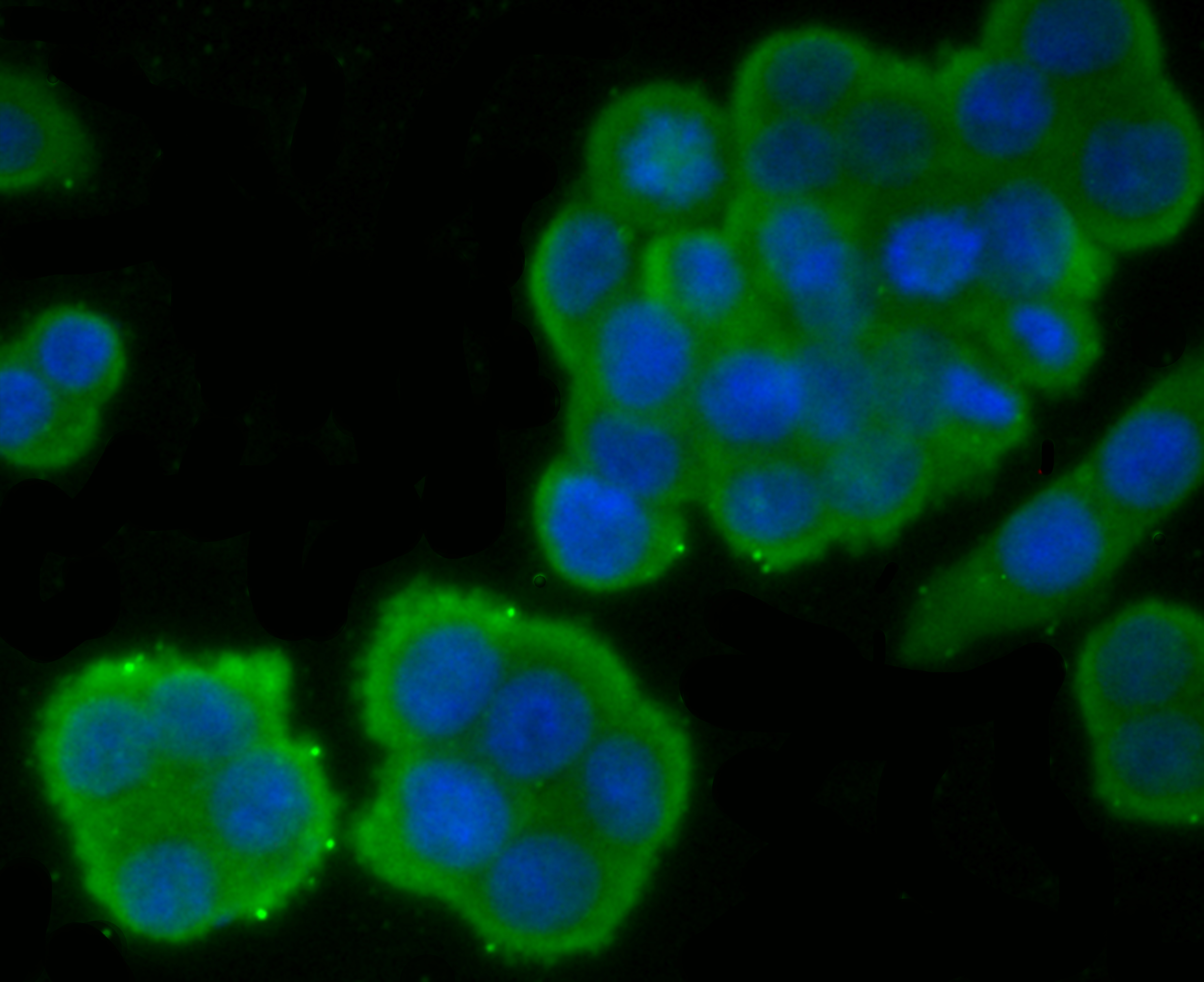 ICC staining EGFR in SW480 cells (green). The nuclear counter stain is DAPI (blue). Cells were fixed in paraformaldehyde, permeabilised with 0.25% Triton X100/PBS.