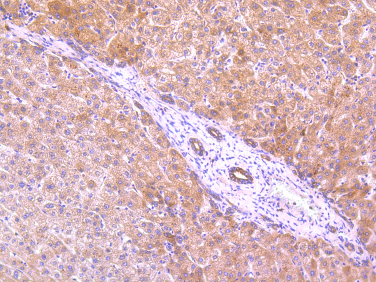 Immunohistochemical analysis of paraffin-embedded human liver tissue using anti-EGFR antibody. Counter stained with hematoxylin.