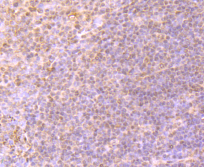 Immunohistochemical analysis of paraffin-embedded human tonsil tissue using anti-Integrin beta-3 antibody. Counter stained with hematoxylin.