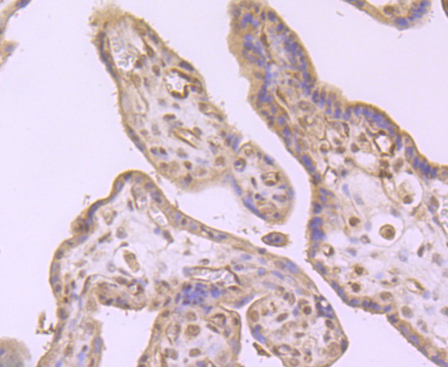 Immunohistochemical analysis of paraffin-embedded human placenta tissue using anti-Integrin beta-3 antibody. Counter stained with hematoxylin.