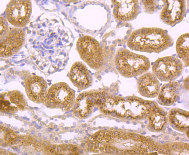 Immunohistochemical analysis of paraffin-embedded mouse kidney tissue using anti-Integrin beta-3 antibody. Counter stained with hematoxylin.