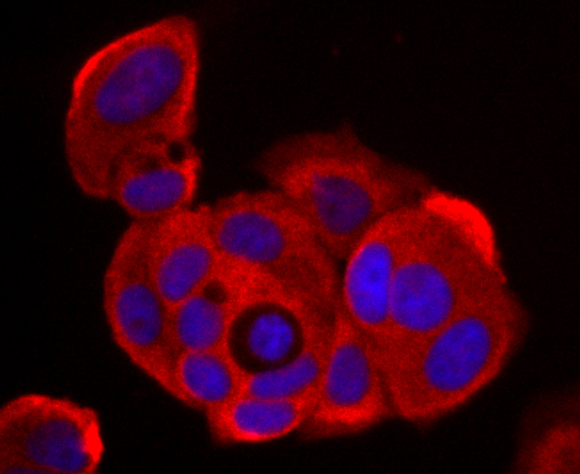 ICC staining NM23 in MCF-7 cells (red). The nuclear counter stain is DAPI (blue). Cells were fixed in paraformaldehyde, permeabilised with 0.25% Triton X100/PBS.