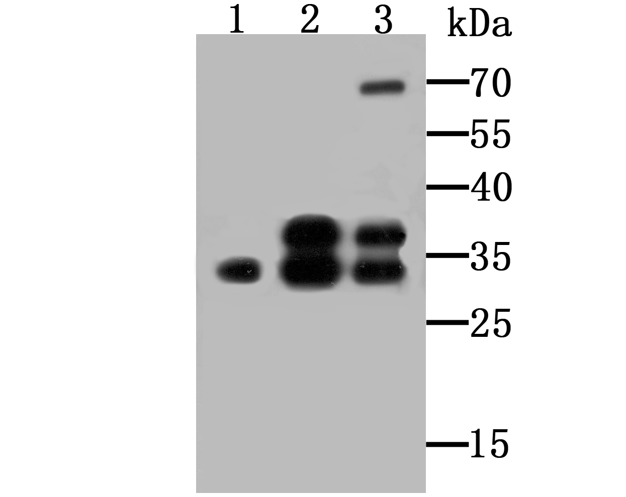 Western blot analysis of SNAI1 on different lysates using anti-SNAI1 antibody at 1/500 dilution.<br />
 Positive control:<br />
 Lane 1: Human kidney tissue<br />
      Lane 2: SiHa<br />
 Lane 3: K562