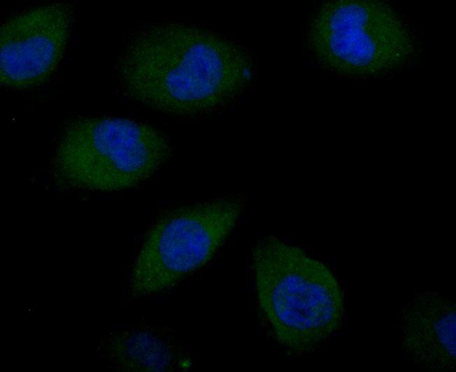 ICC staining SNAI1 in HUVEC cells (green). The nuclear counter stain is DAPI (blue). Cells were fixed in paraformaldehyde, permeabilised with 0.25% Triton X100/PBS.