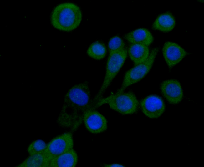 ICC staining SNAI1 in LOVO cells (green). The nuclear counter stain is DAPI (blue). Cells were fixed in paraformaldehyde, permeabilised with 0.25% Triton X100/PBS.