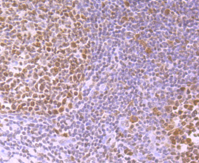Immunohistochemical analysis of paraffin-embedded human tonsil tissue using anti-SNAI1 antibody. Counter stained with hematoxylin.