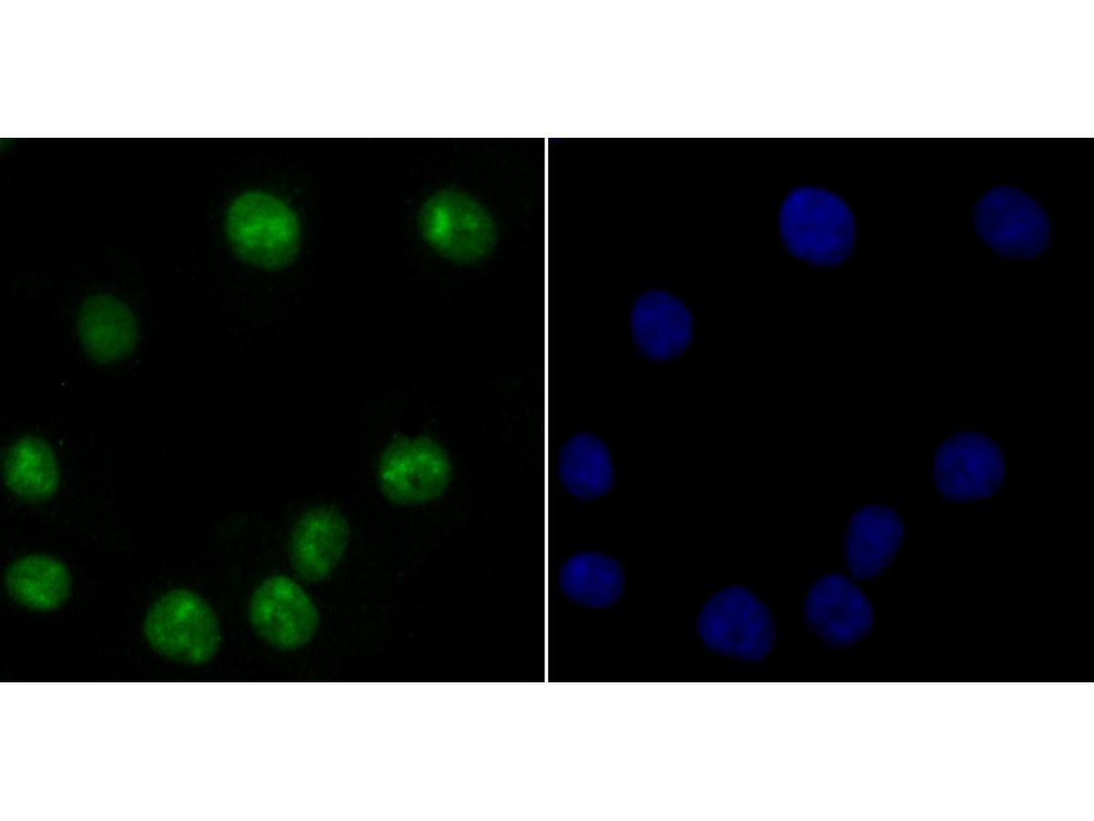 ICC staining USP36 in A549 cells (green). The nuclear counter stain is DAPI (blue). Cells were fixed in paraformaldehyde, permeabilised with 0.25% Triton X100/PBS.