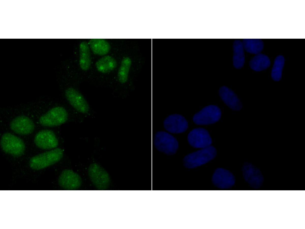 ICC staining USP36 in Hela cells (green). The nuclear counter stain is DAPI (blue). Cells were fixed in paraformaldehyde, permeabilised with 0.25% Triton X100/PBS.