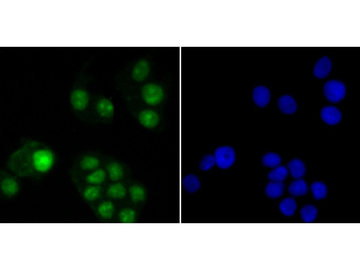 ICC staining USP36 in LOVO cells (green). The nuclear counter stain is DAPI (blue). Cells were fixed in paraformaldehyde, permeabilised with 0.25% Triton X100/PBS.