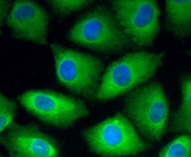 ICC staining ROBO1 in A549 cells (green). The nuclear counter stain is DAPI (blue). Cells were fixed in paraformaldehyde, permeabilised with 0.25% Triton X100/PBS.