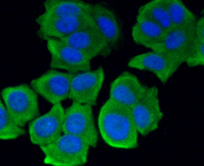 ICC staining ROBO1 in MCF-7 cells (green). The nuclear counter stain is DAPI (blue). Cells were fixed in paraformaldehyde, permeabilised with 0.25% Triton X100/PBS.