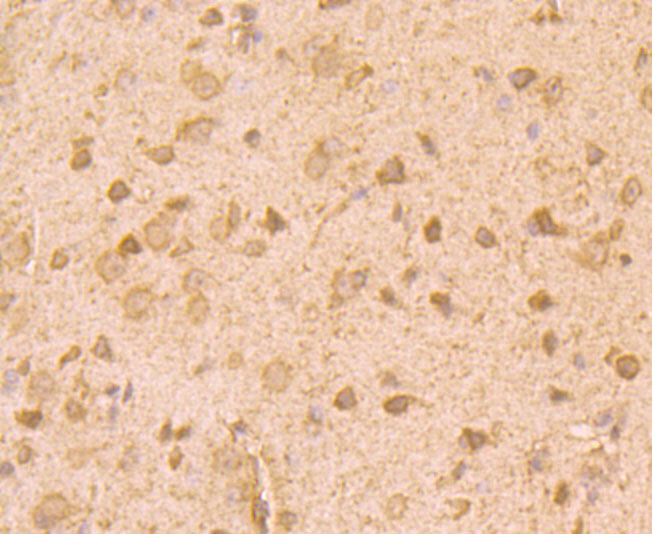 Immunohistochemical analysis of paraffin-embedded mouse brain tissue using anti-ROBO1 antibody. Counter stained with hematoxylin.