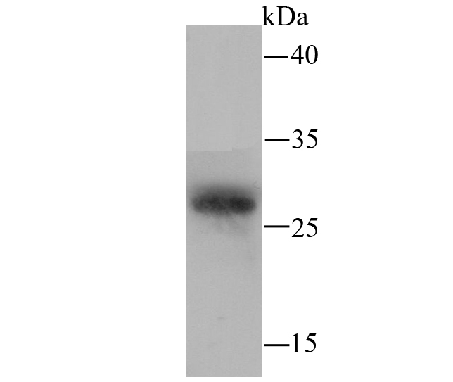 Western blot analysis of PRTN3 on mouse marrow lysate using anti-PRTN3 antibody at 1/100 dilution.