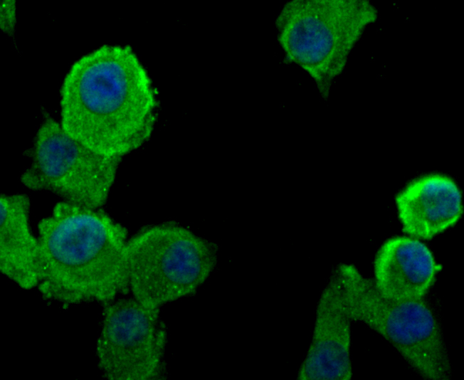 ICC staining PRTN3 in A549 cells (green). The nuclear counter stain is DAPI (blue). Cells were fixed in paraformaldehyde, permeabilised with 0.25% Triton X100/PBS.
