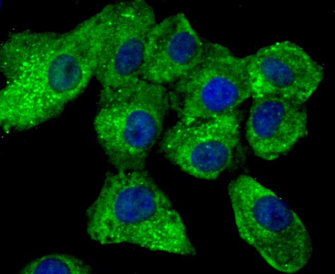 ICC staining TGM6 in A549 cells (green). The nuclear counter stain is DAPI (blue). Cells were fixed in paraformaldehyde, permeabilised with 0.25% Triton X100/PBS.