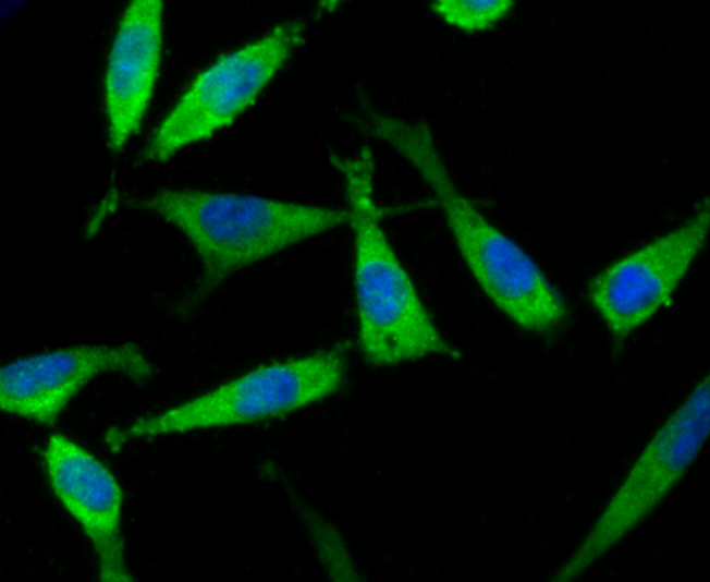 ICC staining TGM6 in SH-SY5Y cells (green). The nuclear counter stain is DAPI (blue). Cells were fixed in paraformaldehyde, permeabilised with 0.25% Triton X100/PBS.