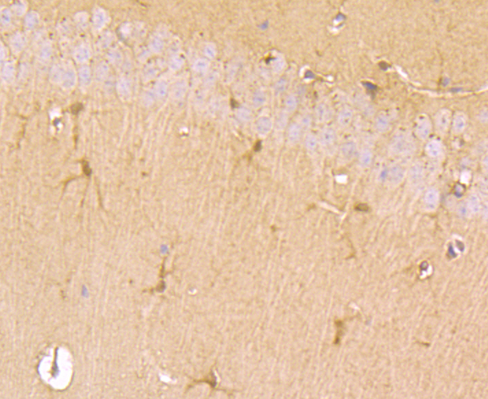 Immunohistochemical analysis of paraffin-embedded mouse brain tissue using anti-TGM6 antibody. Counter stained with hematoxylin.