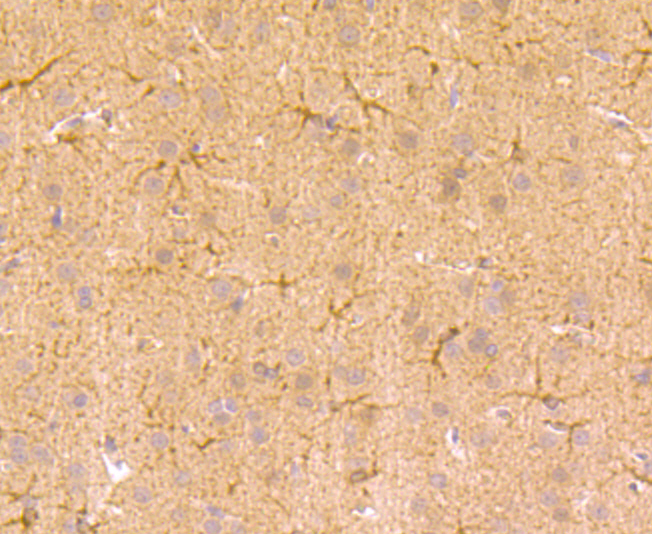 Immunohistochemical analysis of paraffin-embedded rat brain tissue using anti-TGM6 antibody. Counter stained with hematoxylin.