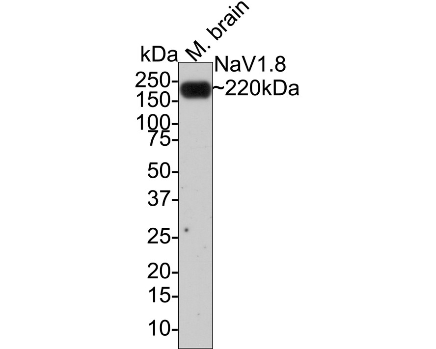 Immunohistochemical analysis of paraffin-embedded mouse brain tissue using anti-NaV1.8 antibody. Counter stained with hematoxylin.