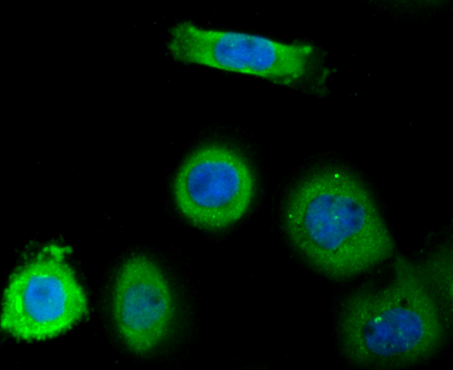 ICC staining TNFAIP3 in A431 cells (green). The nuclear counter stain is DAPI (blue). Cells were fixed in paraformaldehyde, permeabilised with 0.25% Triton X100/PBS.