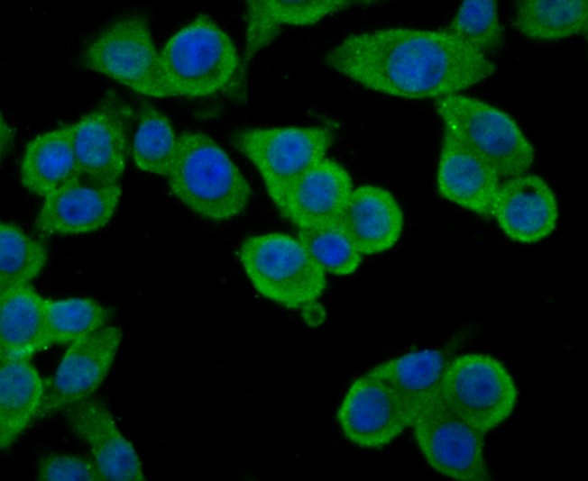 ICC staining TNFAIP3 in LOVO cells (green). The nuclear counter stain is DAPI (blue). Cells were fixed in paraformaldehyde, permeabilised with 0.25% Triton X100/PBS.