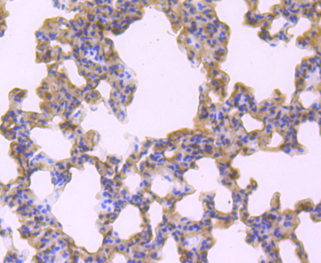 Immunohistochemical analysis of paraffin-embedded rat lung tissue using anti-TNFAIP3 antibody. Counter stained with hematoxylin.