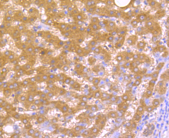 Immunohistochemical analysis of paraffin-embedded human kidney tissue using anti-TNFAIP3 antibody. Counter stained with hematoxylin.