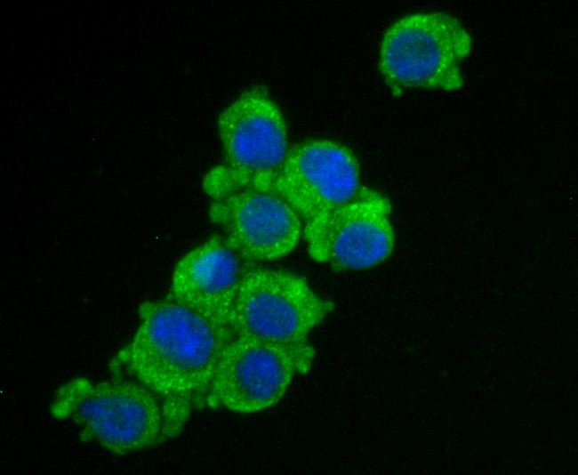 ICC staining ZIP12 in N2A cells (green). The nuclear counter stain is DAPI (blue). Cells were fixed in paraformaldehyde, permeabilised with 0.25% Triton X100/PBS.