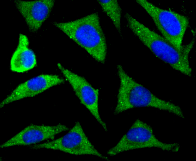 ICC staining ZIP12 in SH-SY5Y cells (green). The nuclear counter stain is DAPI (blue). Cells were fixed in paraformaldehyde, permeabilised with 0.25% Triton X100/PBS.