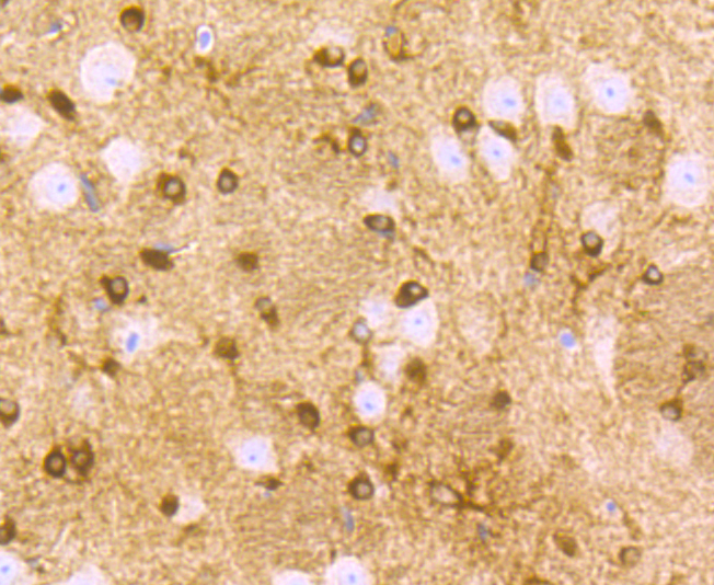 Immunohistochemical analysis of paraffin-embedded mouse brain tissue using anti-ZIP12 antibody. Counter stained with hematoxylin.