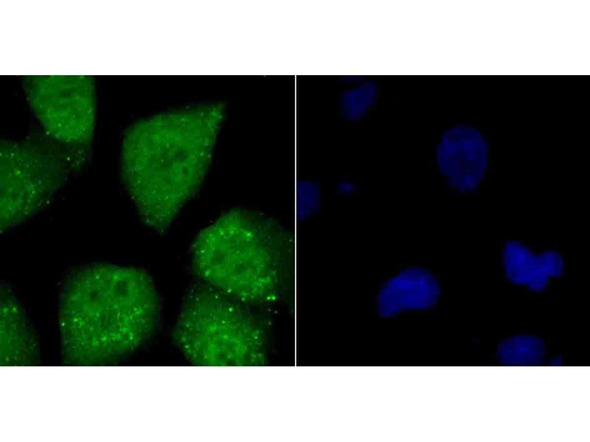 ICC staining ATF6 in HUVEC cells (green). The nuclear counter stain is DAPI (blue). Cells were fixed in paraformaldehyde, permeabilised with 0.25% Triton X100/PBS.