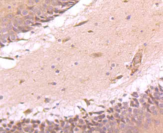 Immunohistochemical analysis of paraffin-embedded rat brain tissue using anti-ATF6 antibody. Counter stained with hematoxylin.