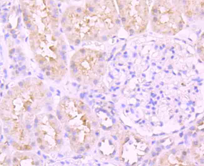 Immunohistochemical analysis of paraffin-embedded human kidney tissue using anti-ATF6 antibody. Counter stained with hematoxylin.