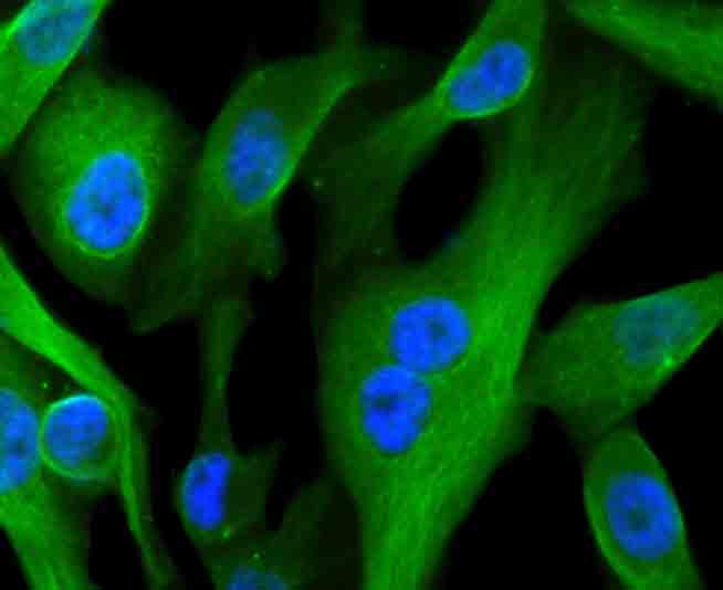 ICC staining CD71 in PC-3M cells (green). The nuclear counter stain is DAPI (blue). Cells were fixed in paraformaldehyde, permeabilised with 0.25% Triton X100/PBS.
