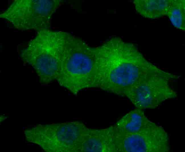 ICC staining CD71 in A549 cells (green). The nuclear counter stain is DAPI (blue). Cells were fixed in paraformaldehyde, permeabilised with 0.25% Triton X100/PBS.