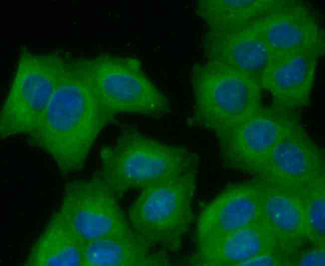 ICC staining CD71 in MCF-7 cells (green). The nuclear counter stain is DAPI (blue). Cells were fixed in paraformaldehyde, permeabilised with 0.25% Triton X100/PBS.