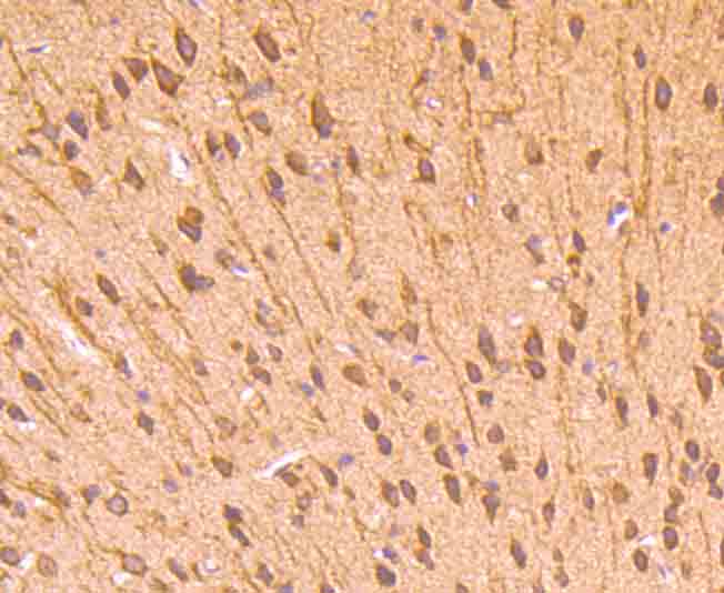 Immunohistochemical analysis of paraffin-embedded mouse brain tissue using anti-CD71 antibody. Counter stained with hematoxylin.