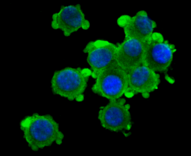 ICC staining Kv1.4 in N2A cells (green). The nuclear counter stain is DAPI (blue). Cells were fixed in paraformaldehyde, permeabilised with 0.25% Triton X100/PBS.