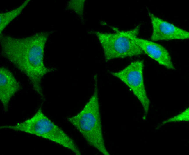ICC staining Kv1.4 in SH-SY5Y cells (green). The nuclear counter stain is DAPI (blue). Cells were fixed in paraformaldehyde, permeabilised with 0.25% Triton X100/PBS.