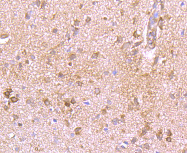 Immunohistochemical analysis of paraffin-embedded rat brain tissue using anti-Kv1.4 antibody. Counter stained with hematoxylin.