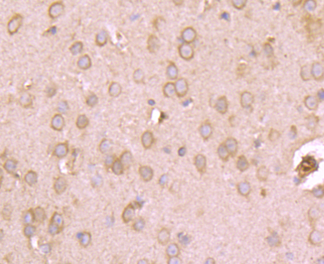 Immunohistochemical analysis of paraffin-embedded mouse brain tissue using anti-Kv1.4 antibody. Counter stained with hematoxylin.
