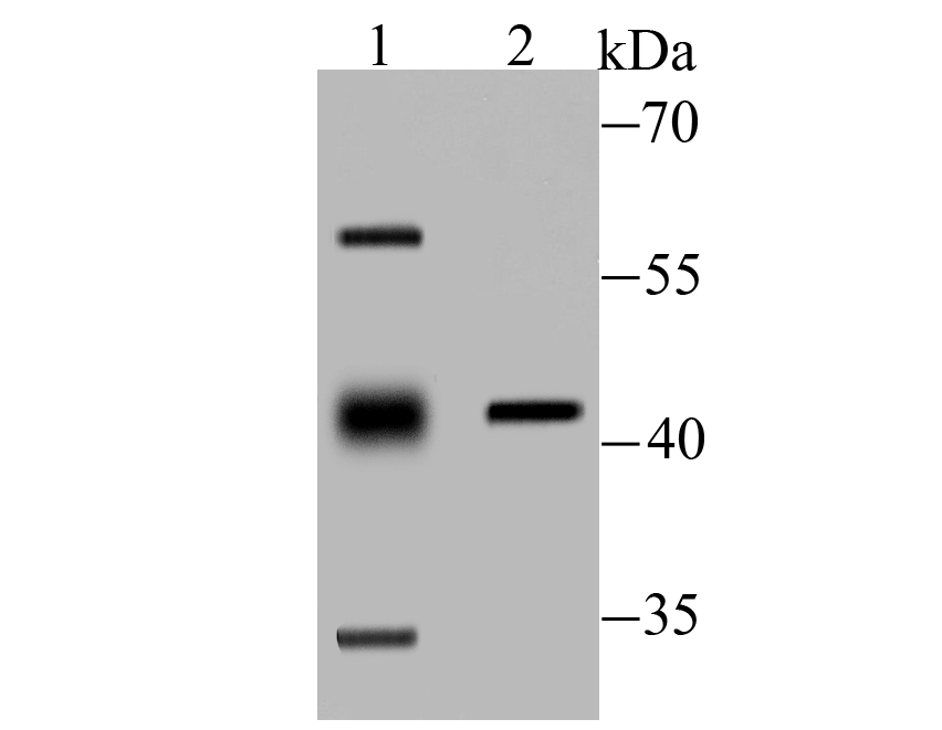 Western blot analysis of PP2C alpha on mouse kidney tissue (1) and rat skin tissue (2) lysate using anti-PP2C alpha antibody at 1/100 dilution.