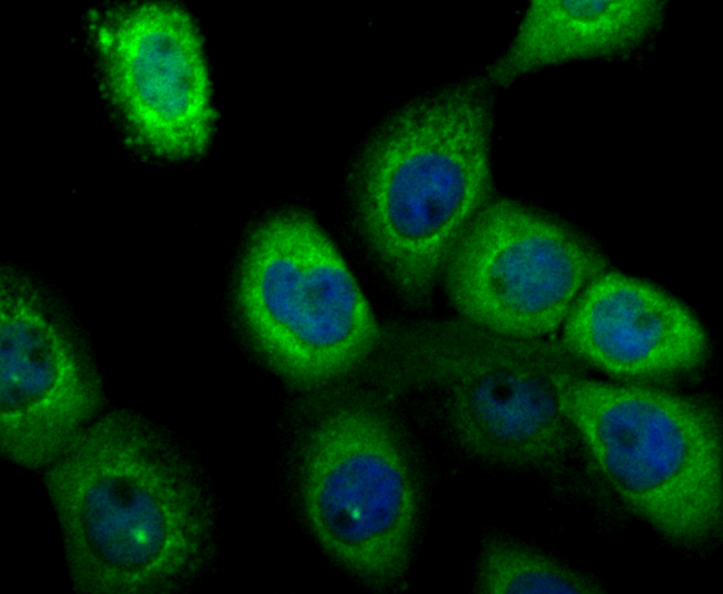 ICC staining PP2C alpha in A431 cells (green). The nuclear counter stain is DAPI (blue). Cells were fixed in paraformaldehyde, permeabilised with 0.25% Triton X100/PBS.
