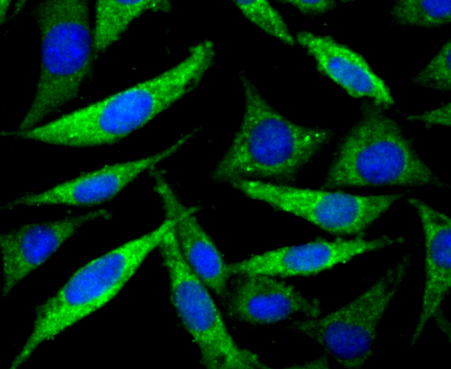 ICC staining PP2C alpha in SH-SY5Y cells (green). The nuclear counter stain is DAPI (blue). Cells were fixed in paraformaldehyde, permeabilised with 0.25% Triton X100/PBS.