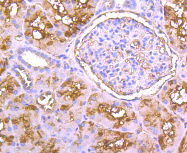 Immunohistochemical analysis of paraffin-embedded human kidney tissue using anti-PP2C alpha antibody. Counter stained with hematoxylin.